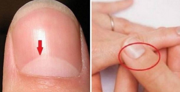 The Half-Moon Shape On Your Nails Can be an Indicator of Many Things