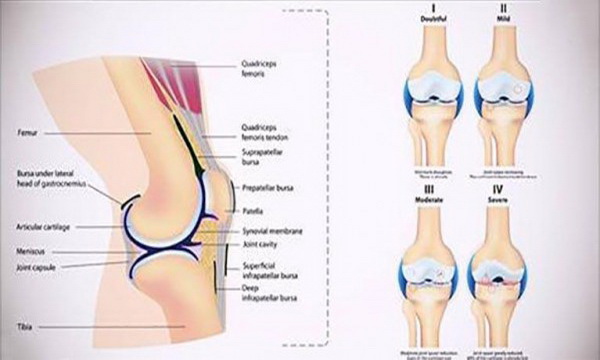 5 Simple Exercises You Can Do To Make Your Knees Strong