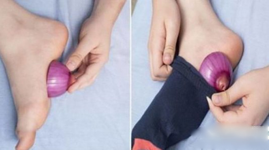 Why Should You Put Onions In Your Socks Before Going To Bed?