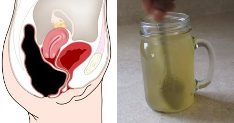 This Simple Drink Removes Pounds of Toxins from Your Colon!