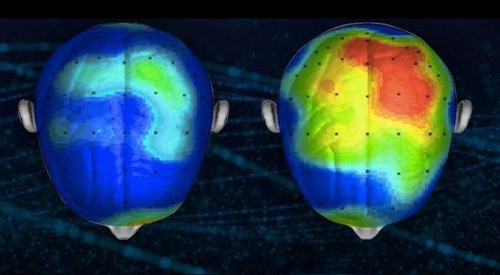 Neuroscientists Discover a Song That Reduces Anxiety By 65 Percent (Listen)