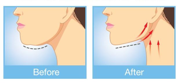 Say goodbye to a double chin with these 3 simple exercises