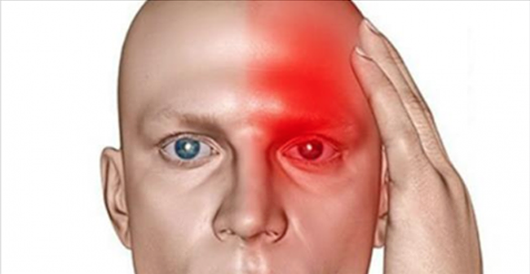 10 Symptoms Which Indicate That You Had A Silent Stroke And That Another One Will Soon Follow