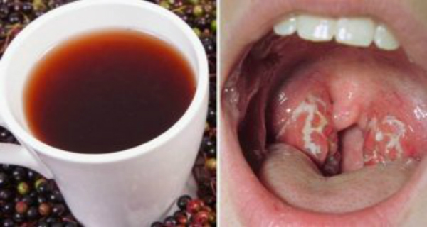 How To Get Rid Of Throat Infection Naturally In Just 4 Hours