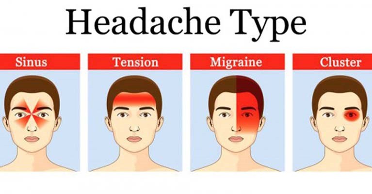 This is How Headaches Reveal What is Wrong With Your Health (And How To Cure It Naturally)!