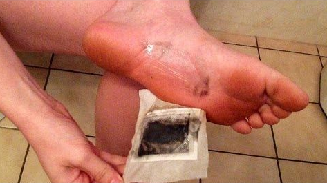 She puts this on her feet every night: You won’t believe the end result!