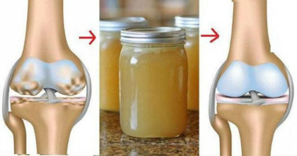 DOCTORS ARE SHOCKED: This mixture regenerate bones and joints!