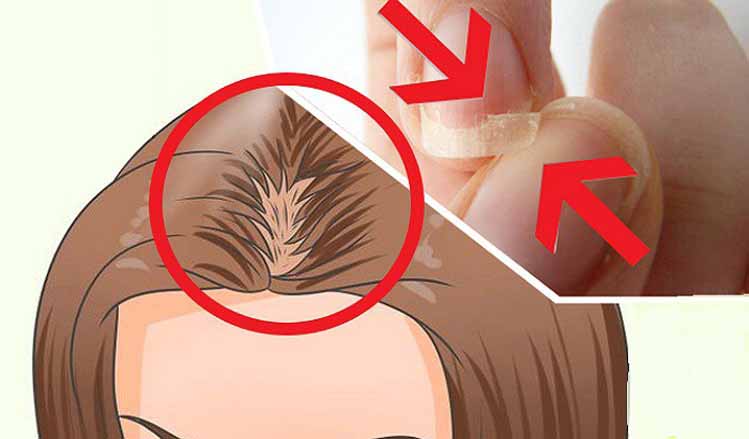 You have Brittle Nails and Your Hair Falls a Lot? Here’s What You’re Missing!