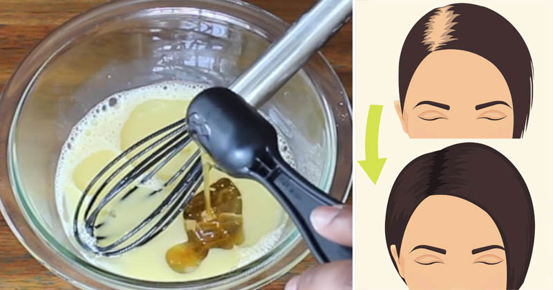 Mix These 3 Ingredients To Regrow Thick, Strong Hair In No Time!