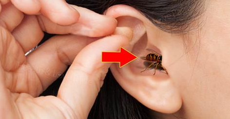 Things You Should and Should Not Do When an Insect Goes into Your Ear