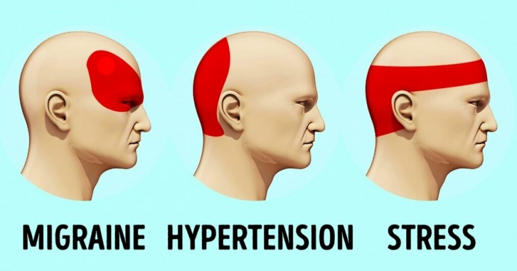 Comment se débarrasser d’un mal de tête sans antalgique en 5 minutes