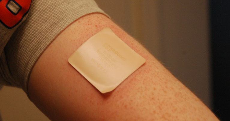 Un patch révolutionnaire traite avec succès la douleur de la fibromyalgie et de la neuropathie diabétique