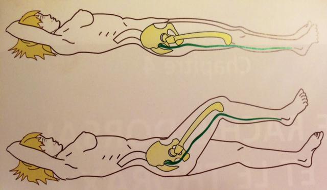 Comment soulager les douleurs d’une sciatique en 60 secondes ?