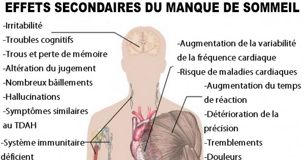 Dépression, maladies cardiaques, diabète…Voici une liste de maladies causées par le manque de sommeil !