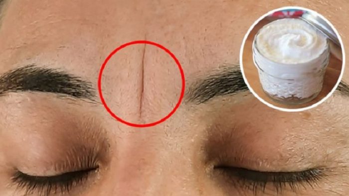 2 masques pour éliminer les ridules entre les sourcils